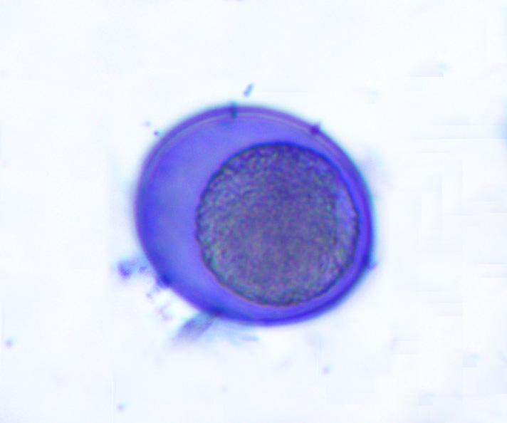 coccidia