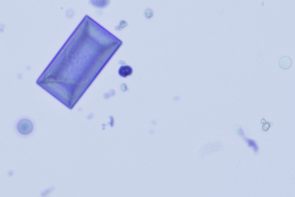 magnesium ammonium phosphate crystal (2)